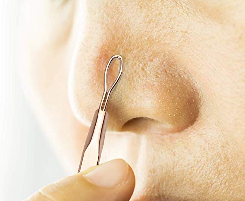 Ellen Tracy Blackhead and Whitehead Extractor, Comedone Extractor Tool for Removing Facial Blemishes Plus 4 Loofah Complexion Discs for Clear and Smooth Skin